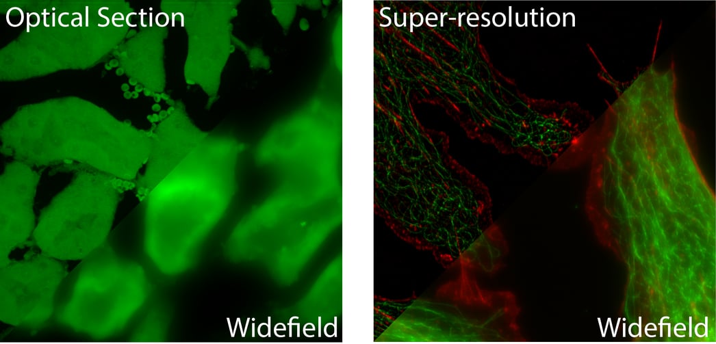 Which Fluorescence Microscopy Techniques is Best for Me?